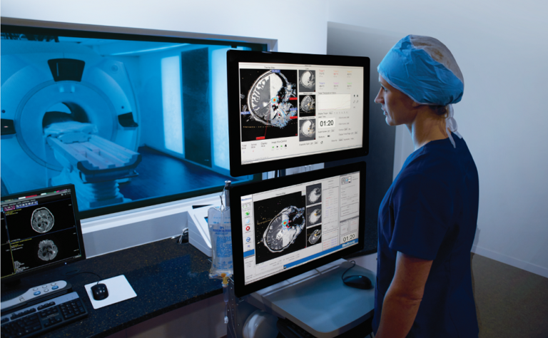 Krembil Brain Institute acquires revolutionary laser ablation system ...