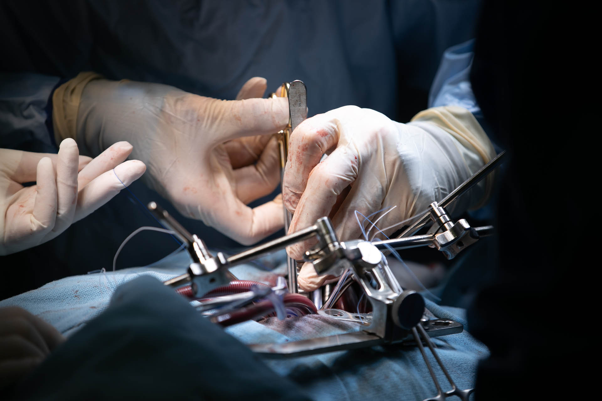 Surgeons performing an operation.