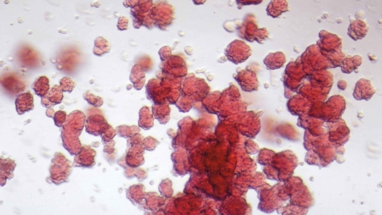 Microscopic image of blood cells made from stem cells. Many red spheres - each is a separate blood cell.