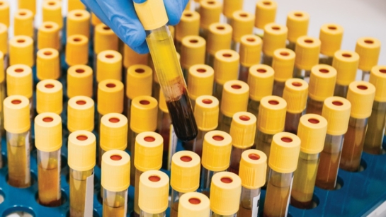 A close up photo a tray of blood samples in rows of tubes. A gloved hand is pulling out one blood tube from the middle.