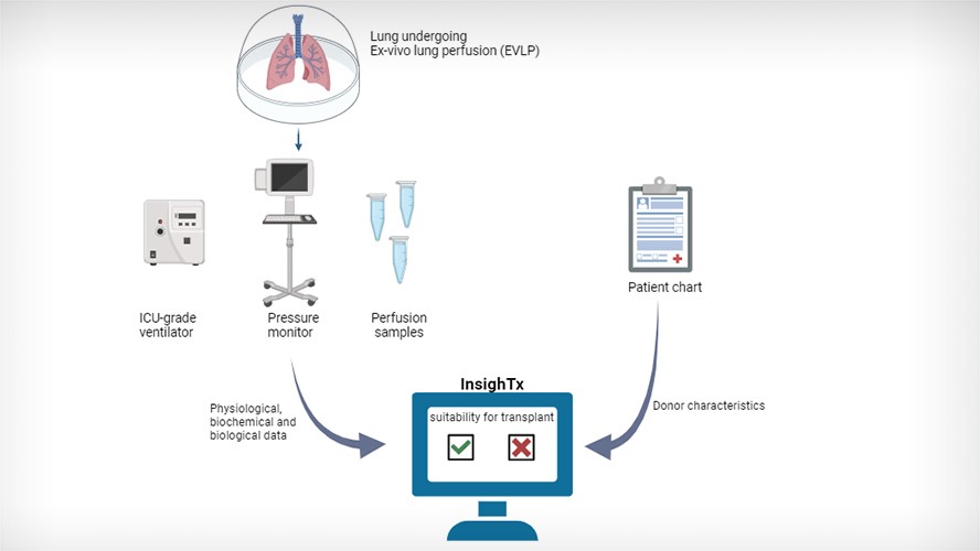 InsighTx uses data from EVLP and donors in order to make a decision on suitability for transplant.