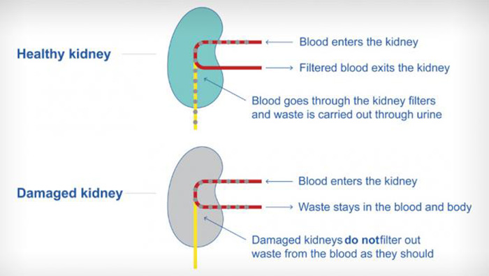 Kidneys play an important role as a filtration system for the body. They remove waste from blood and regulate the balance of salt, potassium and other chemicals in the body. (Image: American Kidney Fund website)