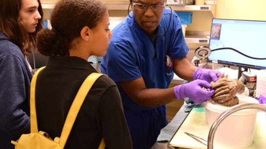 Lester McDonald shows students the diseased lungs of a patient who had a successful lung transplant