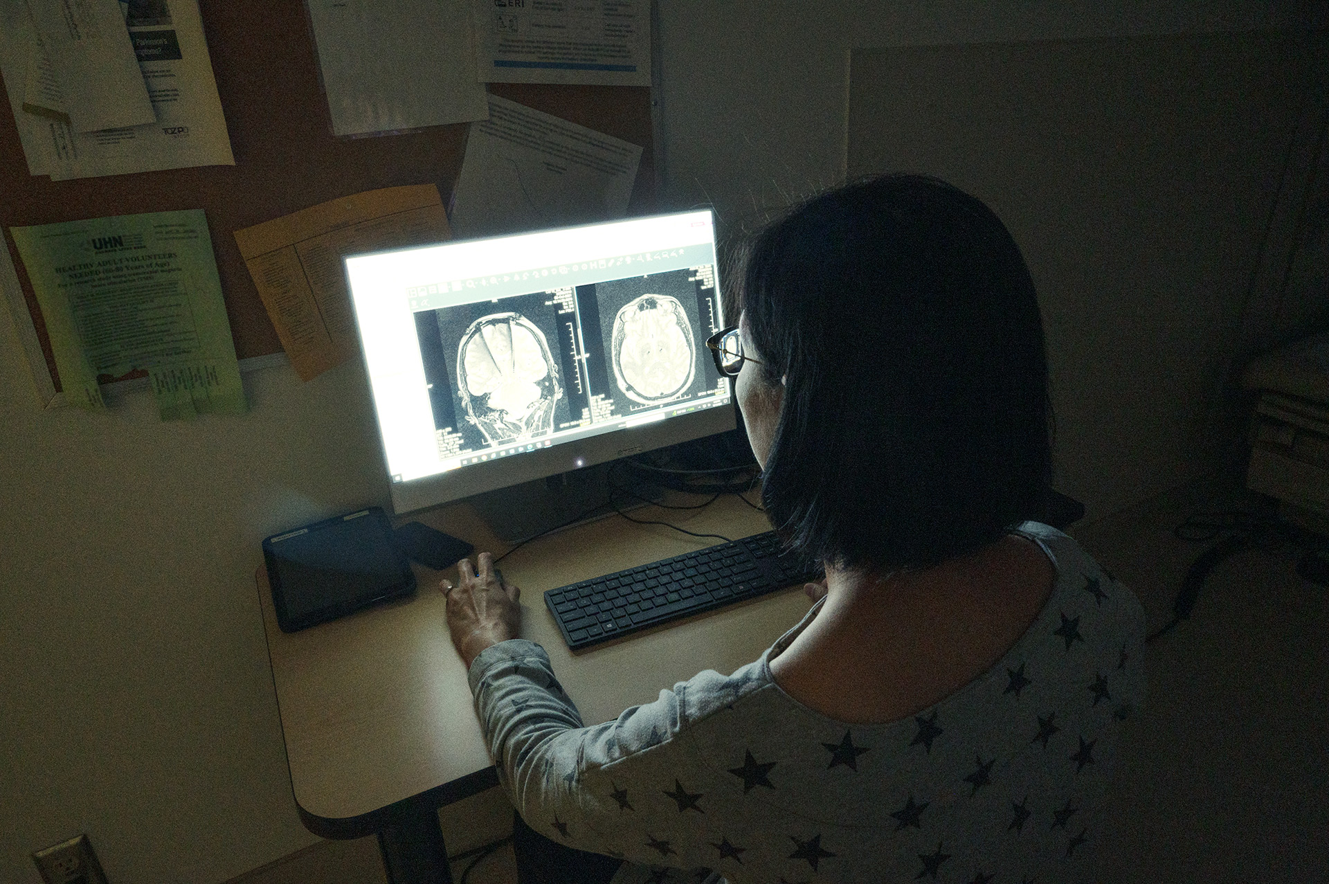 A research coordinator looking at scans on her screen in the Parkinson's clinic at Toronto 