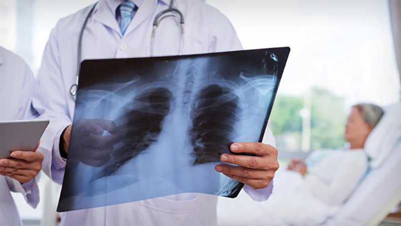 A medical professional holding x-rays of the chest.