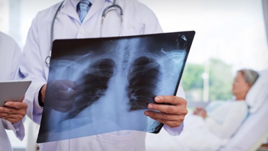 A medical professional holding an x-ray