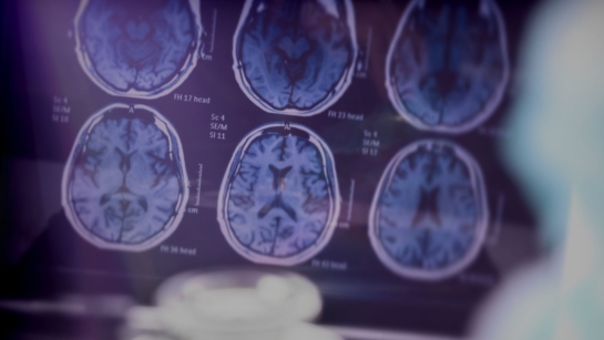 Brain scans