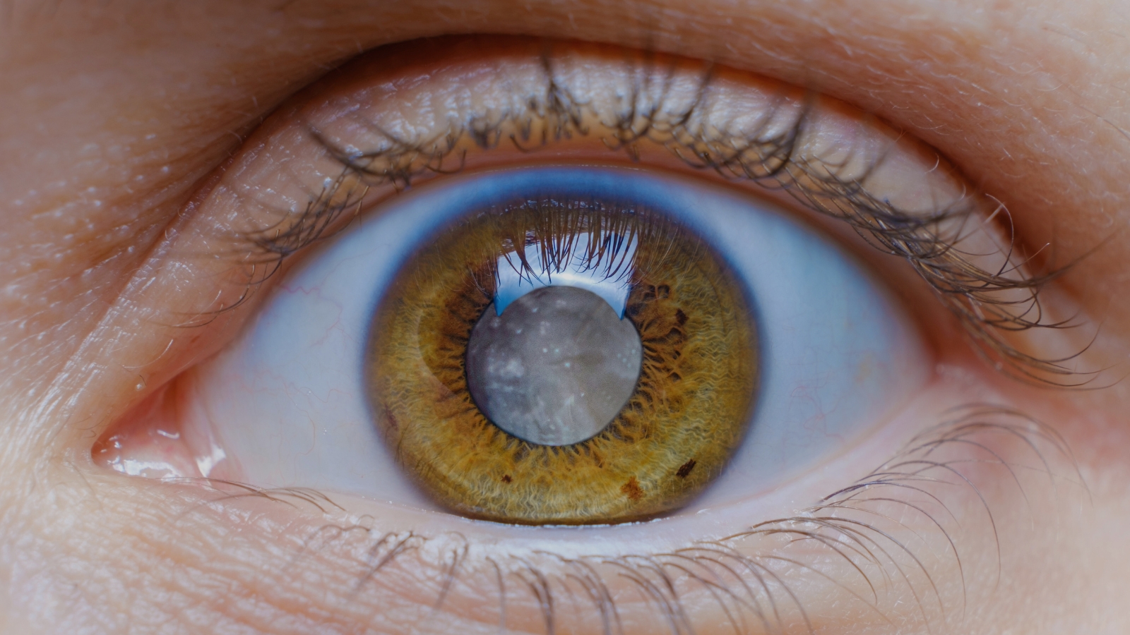 Close-up view of a human eye with detailed capture of the iris, eyelashes, and reflection of a window in the pupil. The eye has a cataract.