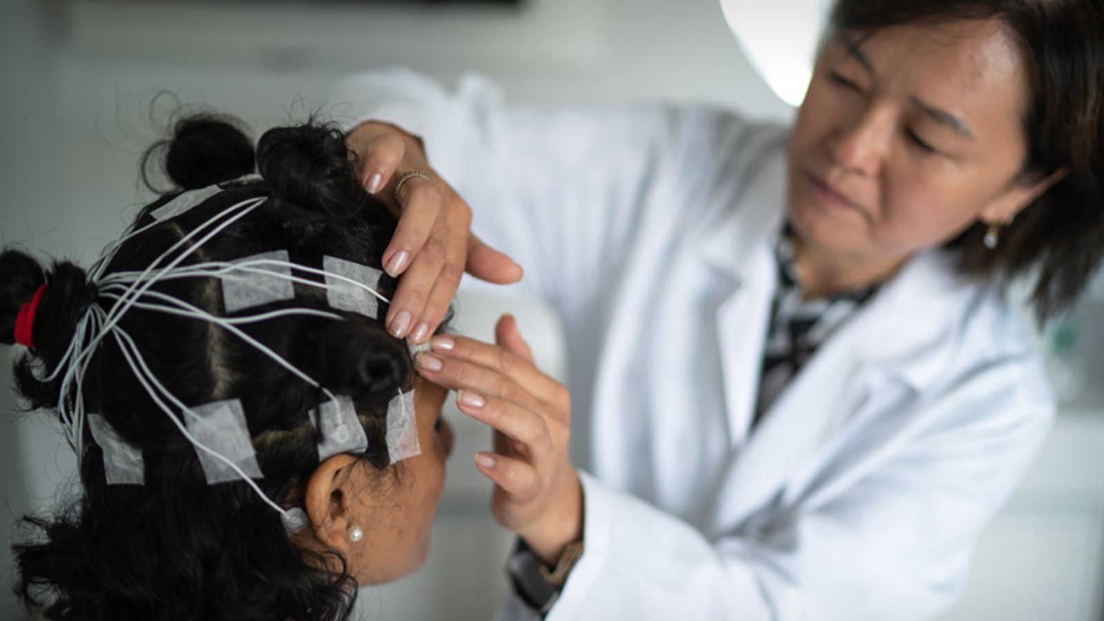 Sensors on a patient's head for epilepsy treatments