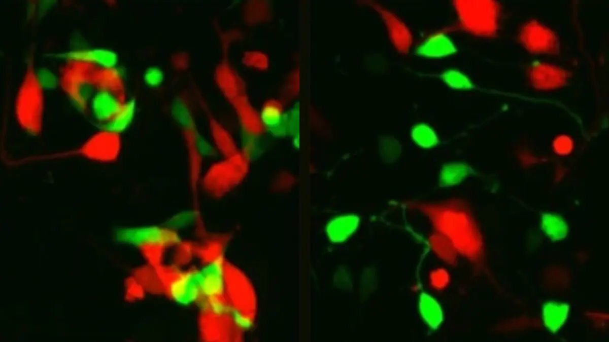 Eye care photoreceptors that are green and red with a black background