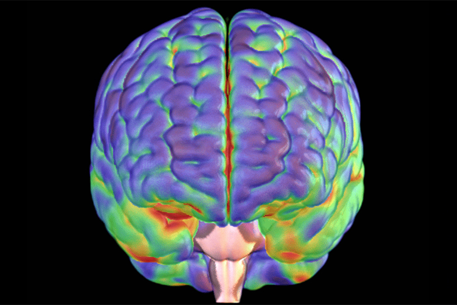 Brain scans reveal hidden damage