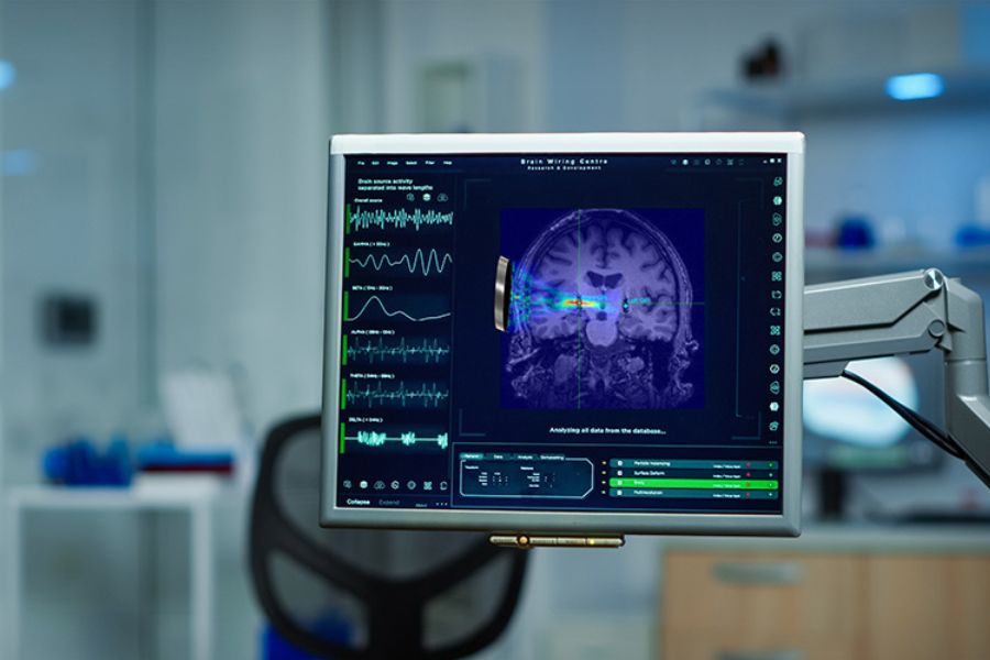 Though not yet widely used, deep-brain stimulation through transcranial ultrasound — ultrasound applied to the brain through the skull — has a lot of potential. Researchers believe it could transform care for a wide range of neurological and psychological conditions, including Parkison’s disease. (Photo: Getty Images)