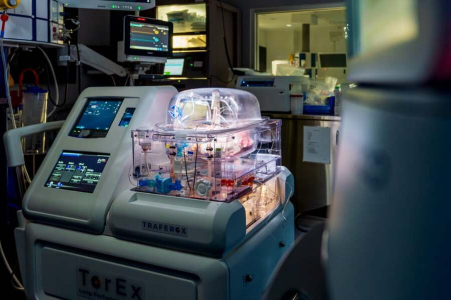 The Ex Vivo Lung Perfusion System