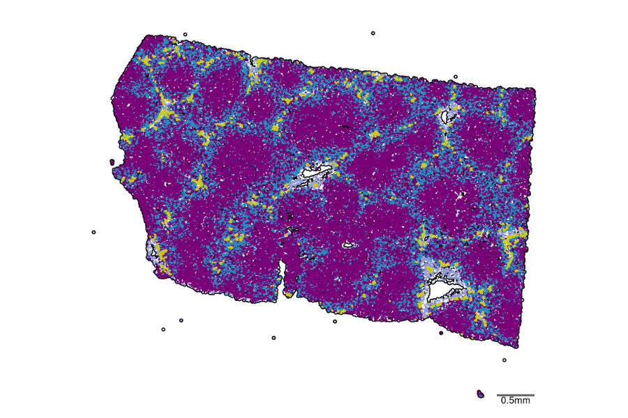 Illustration showing thousands of individual cells within a piece of human liver tissue. Each dot represents a single cell, coloured to show the cell type, revealing how different cells are organized across the liver.